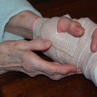 Ann Roberts' hand